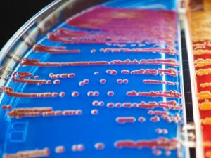 how long does probiotic strains take