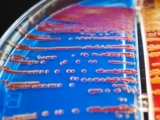 How Long Do Probiotics Take to Work?